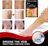 Patchs Herbales Anti-Varices