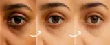 Eye Revive محاربة الهالات و الانتفاخ تحت العينين