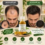 زيت تطويل الشعر وملا الفراغات