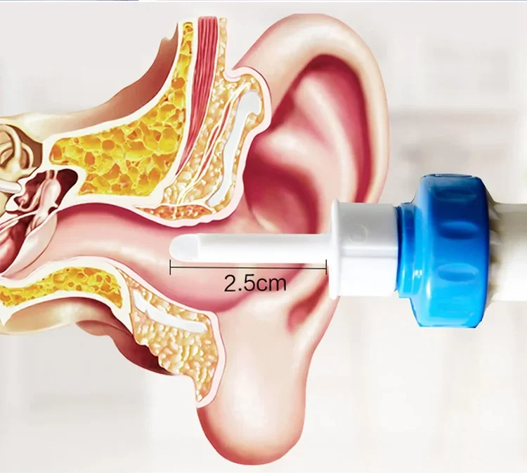 جهاز إزالة شمع الأذن  c-ears آمن ولطيف
