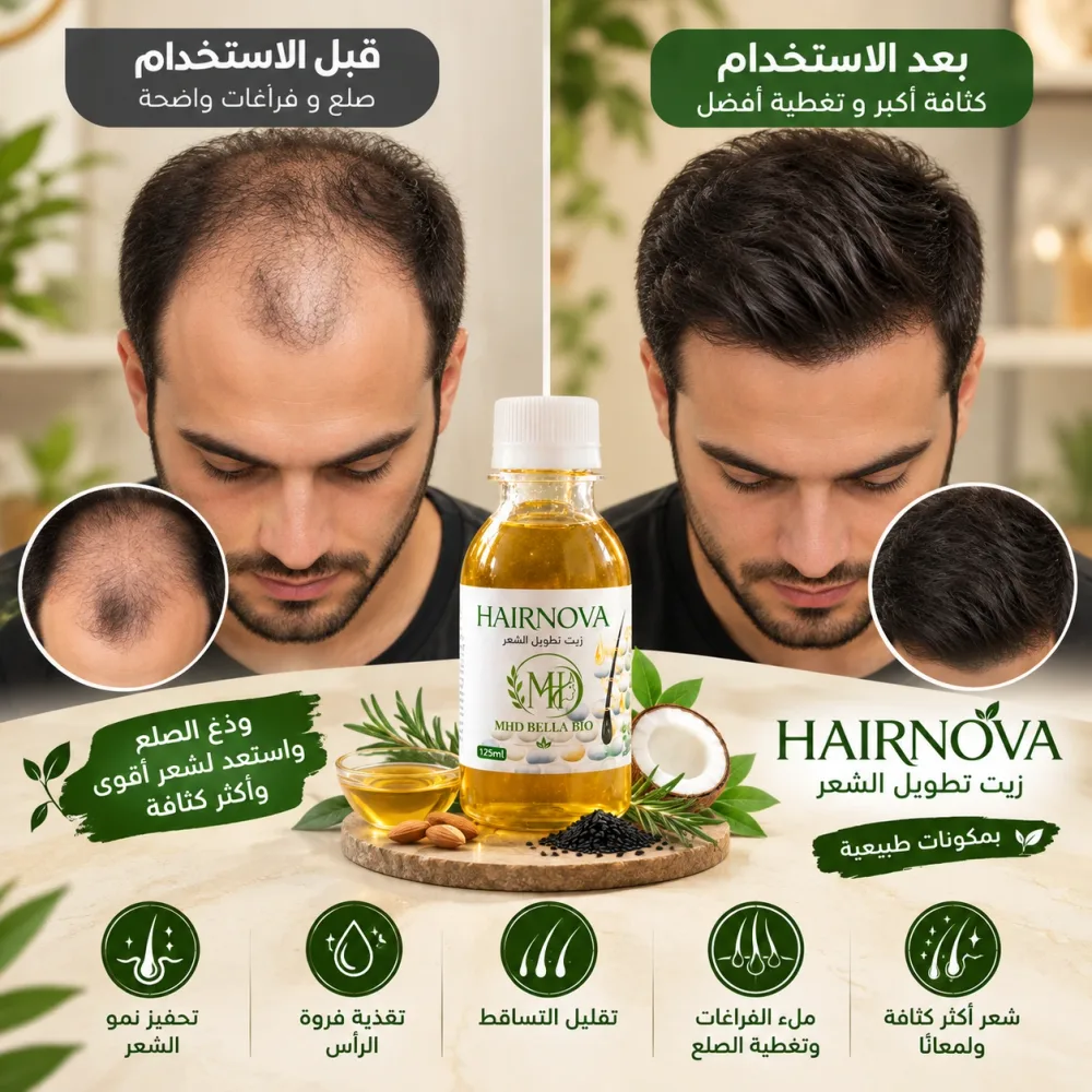 زيت تطويل الشعر وملا الفراغات