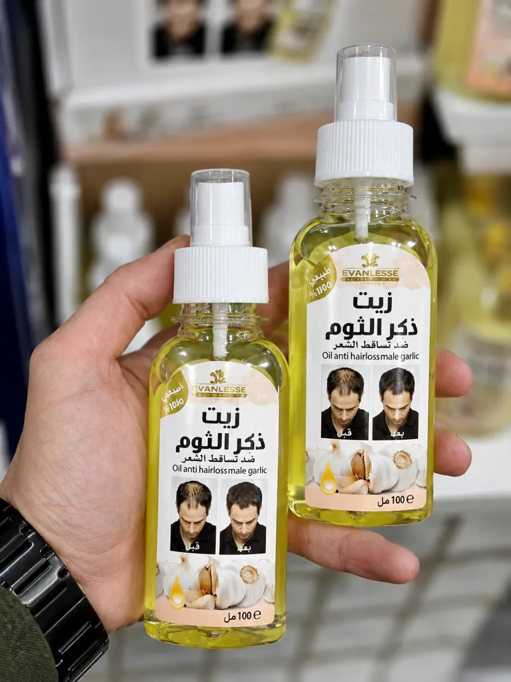 باقة الثوم الذكر للشعر