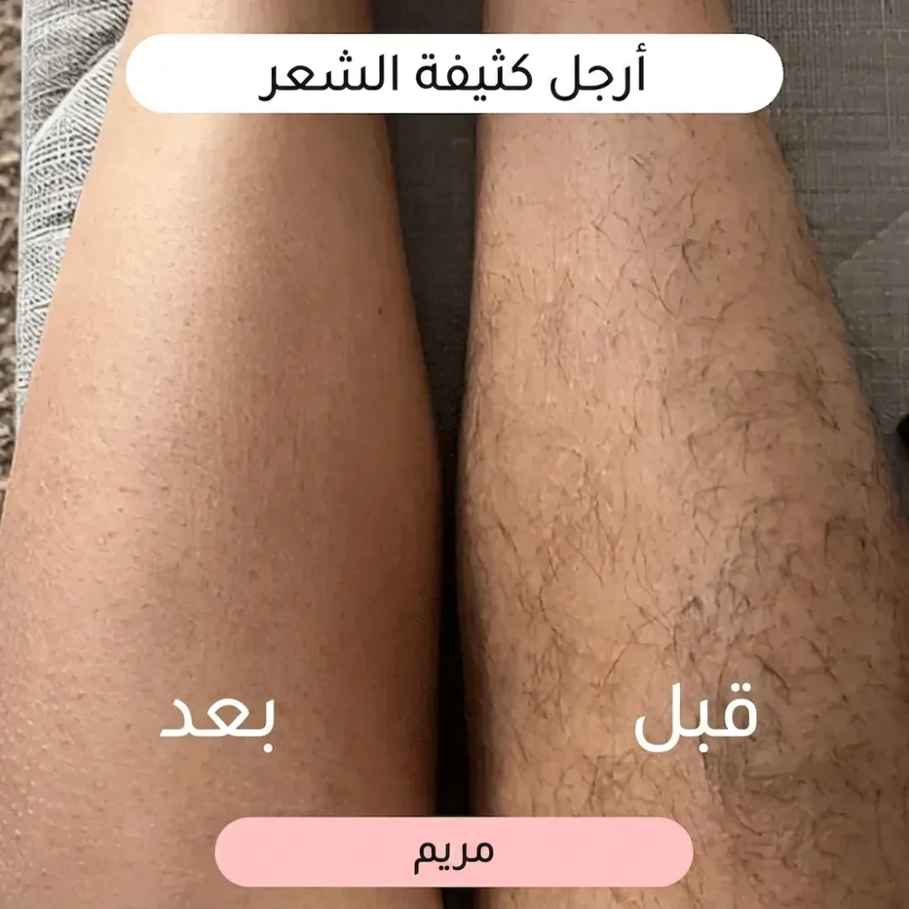ماكينة حلاقة نسائية 2 في 1 🌸(عرض خاص لفترة محدودة فقط!)
