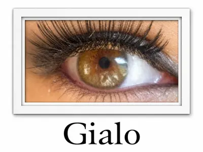 Gialo lentille