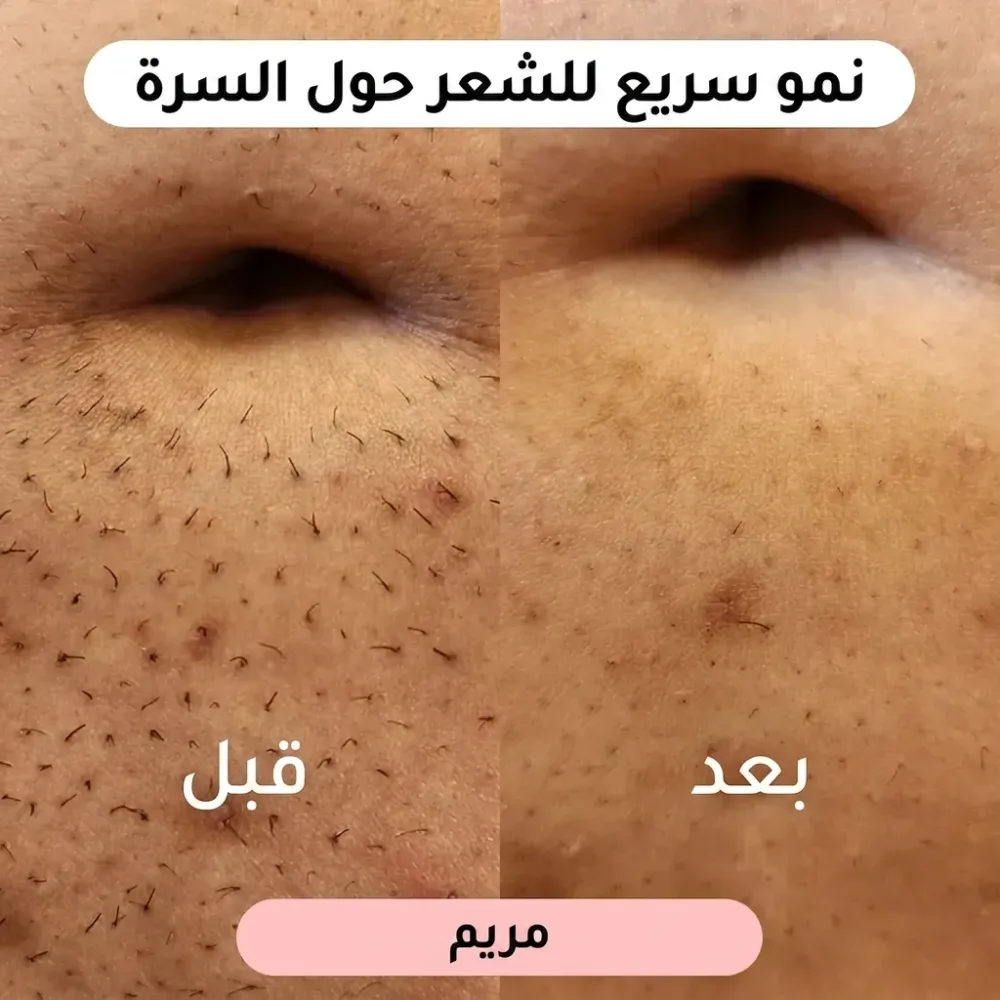 ماكينة حلاقة نسائية 2 في 1 🌸(عرض خاص لفترة محدودة فقط!)
