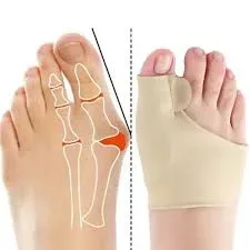 dispositif orthopédique souple conçu pour soulager les douleurs liées à l'oignon du pied