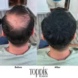 Toppik الأصلي لتكثيف الشعر - لون أسود داكن (27.5g)