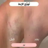 ماكينة حلاقة نسائية 2 في 1 🌸(عرض خاص لفترة محدودة فقط!)