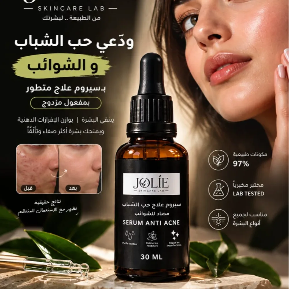 سيروم علاج حب الشباب والشوائب – لتنقية البشرة وتقليل مظهر الحبوب