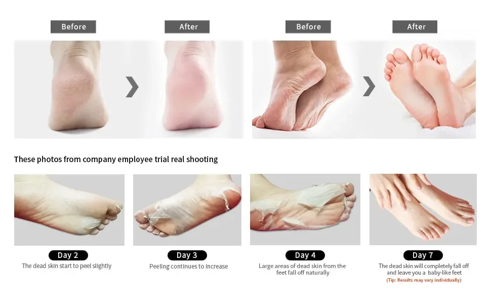 LVENDER FOOT MASK