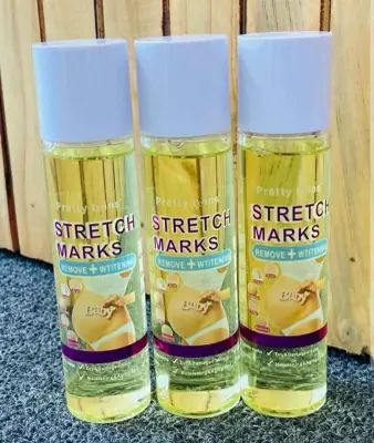 Pretty Twins Stretch Marks