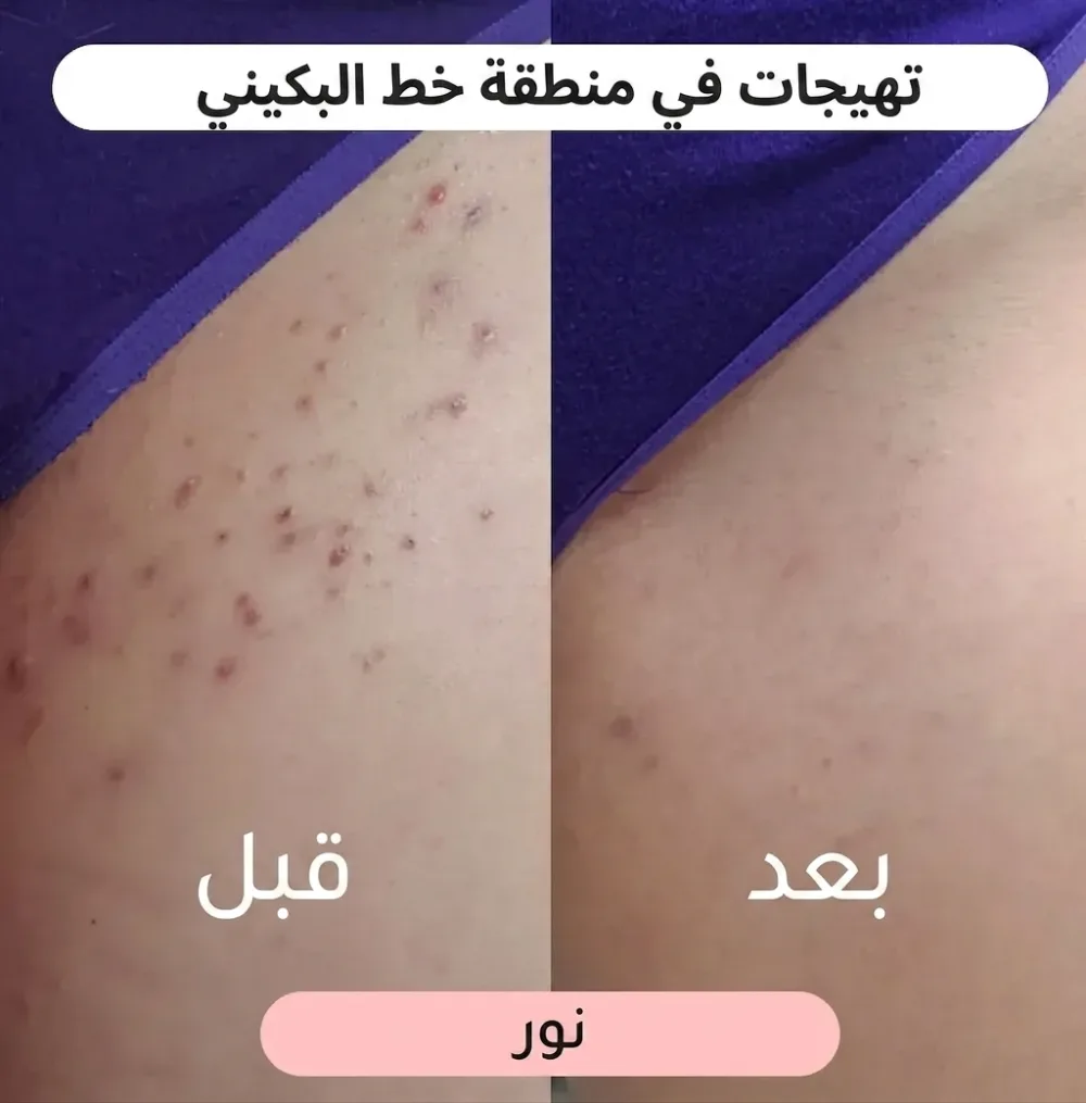 ماكينة حلاقة نسائية 2 في 1 🌸(عرض خاص لفترة محدودة فقط!)