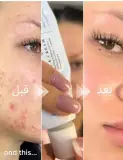 Dr. Althea 345 Relief Cream (أصلية) تلقايه ماشي أصلي اتصلي نرجعولك دراهمك
