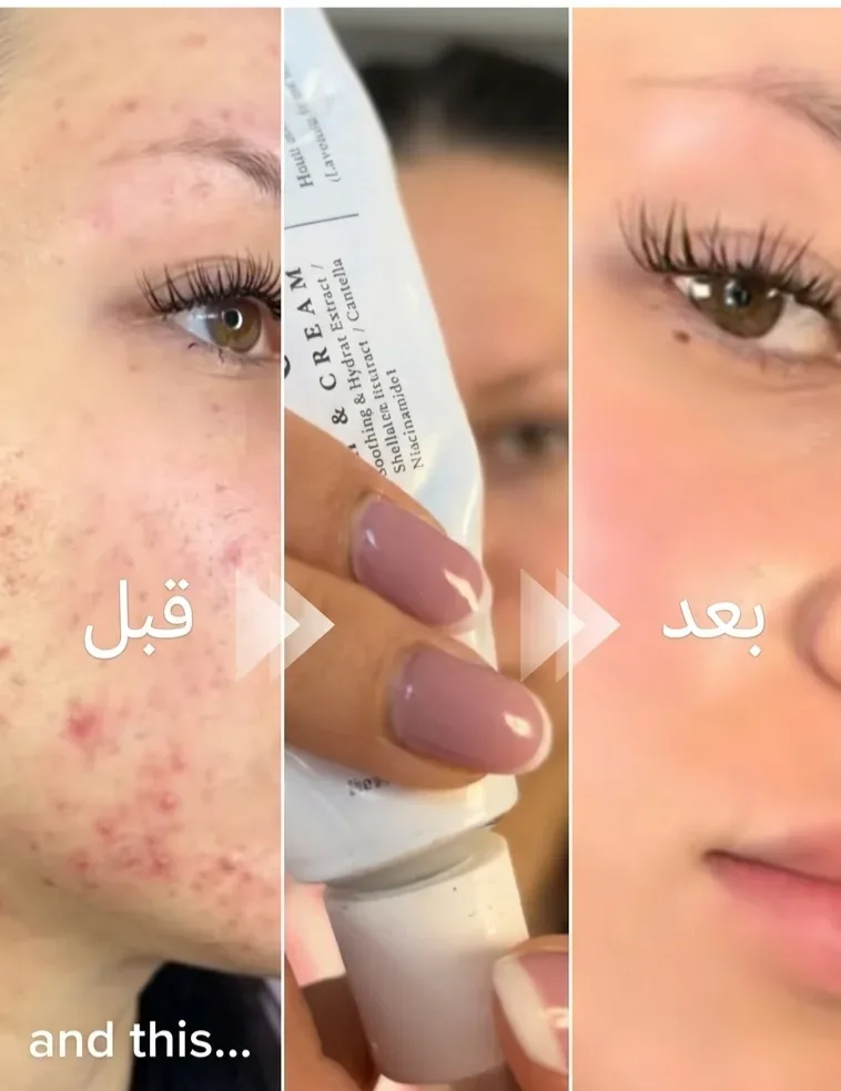 Dr. Althea 345 Relief Cream (أصلية) تلقايه ماشي أصلي اتصلي نرجعولك دراهمك